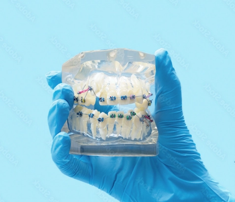 A hand holding a pair of dental braces.
